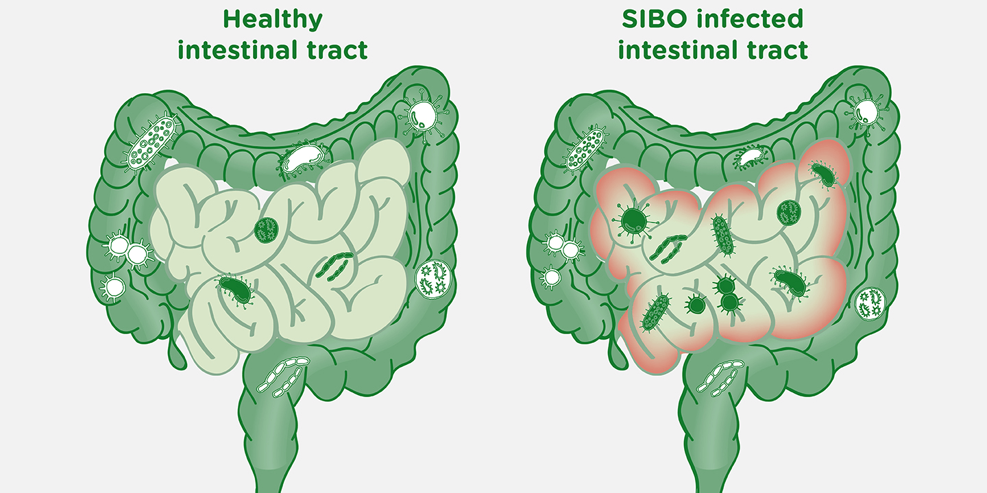 Flora mixta intestinal