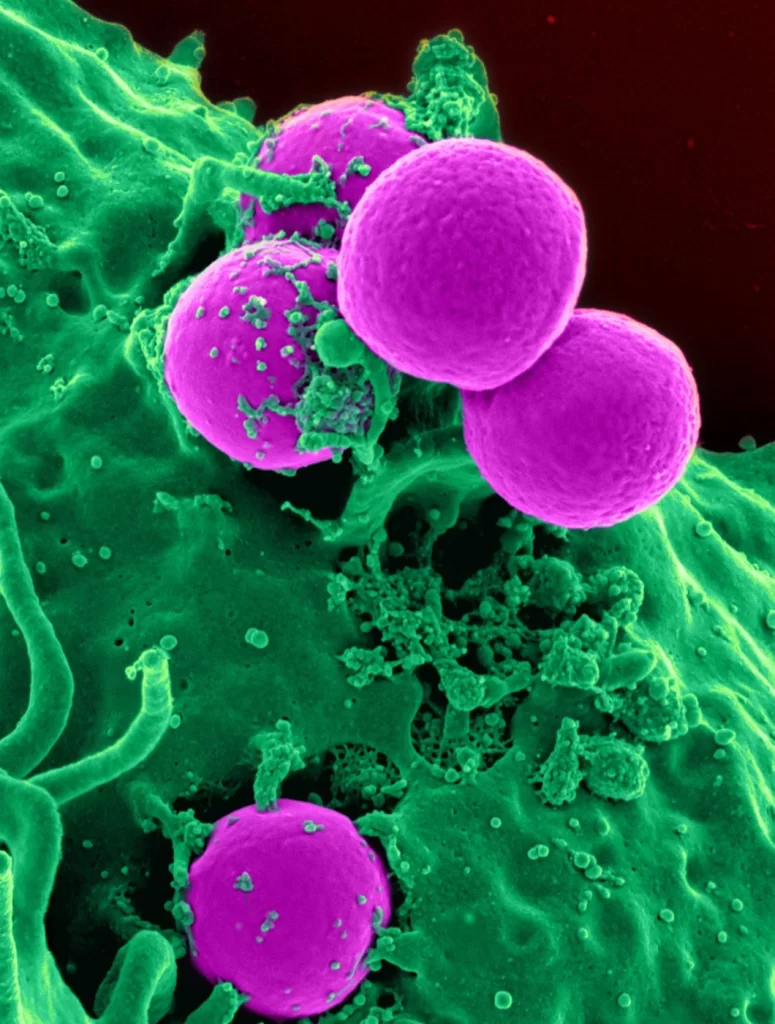 gut microbiome
